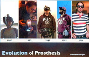 Evolution of prosthesis